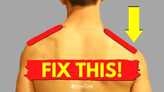 Understanding Shoulder Pain and How To Fix It [upl. by Ogdon]