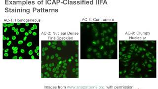 Antinuclear Antibody Testing [upl. by Onofredo]