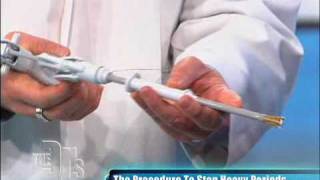 Novasure Procedure Performed on The Doctors [upl. by Radec]