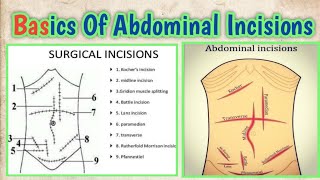 Basic Anatomy Of Abdominal Incisions l abhishekghoolibmcri [upl. by Ferri797]