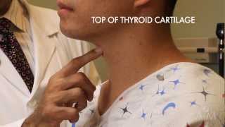 The Thyroid Exam Stanford Medicine 25 [upl. by Aratak]