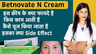 Betamethasone Valerate and Neomycin Skin Cream  Betnovate N Cream for Face  Uses [upl. by Cointon]