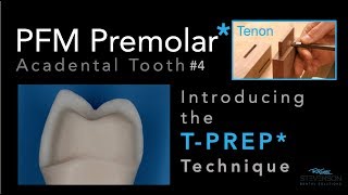 PFM Premolar Using TPREP Technique  Acadental Tooth 4 [upl. by Aimar854]