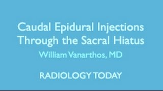 Caudal Epidural Injections and Hip Pain Imaging [upl. by Asyram]