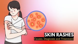 Skin Rash Causes Signs and Symptoms Diagnosis and Treatment [upl. by Aehr]