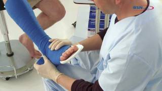 Synthetic splinting reinforced posterior leg splintENby BSN medical [upl. by Aznarepse]