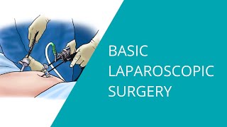 Basic Laparoscopic Surgery [upl. by Lowry]