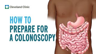 Tips to Prepare for Your Colonoscopy [upl. by Eninej633]