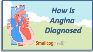 How is Angina Diagnosed [upl. by Reiner979]