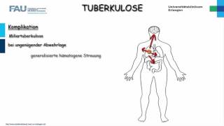 Pathologie ─ Tuberkulose [upl. by Nosiddam]