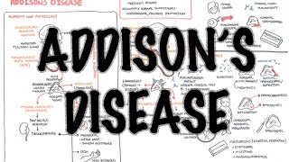 Addisons Disease  Overview clinical features pathophysiology investigations treatment [upl. by Down]