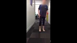 Pigeon Toe Gait Correction with Spiral Thigh Brace  061  Part 2 of 2 [upl. by Mikael]