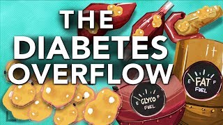 Obesity amp Diabetes Explained The Overflow Phenomenon [upl. by Tut]