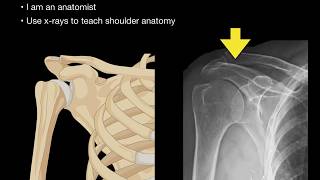 Anatomy of Shoulder Xrays [upl. by Dowski]